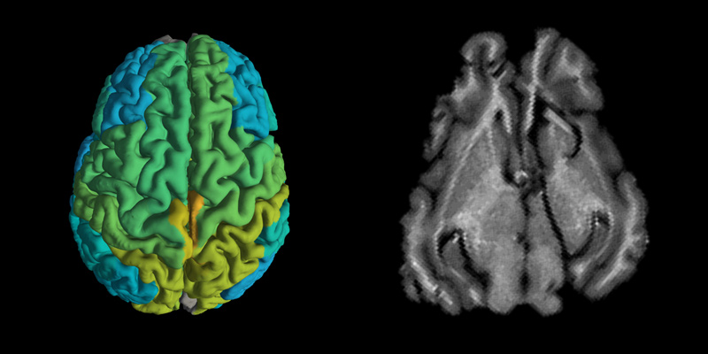 Standard MRI brain scan of a pig, right, and a new MRI scan showing differences in molecular makeup in different parts of the brain.