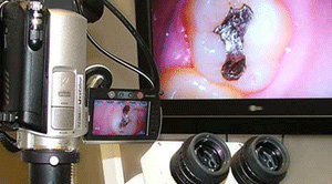 Microscopy in dentistry
