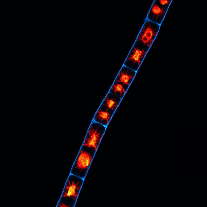 In the past, the researchers identified a gene in Zygnema algae that could play a role in stress hormone regulation. Now they have characterized the gene's function. The image was taken by confocal laser-scanning microscopy and shows cell walls (in blue) and chloroplasts (in red) of the Zygnema algae.