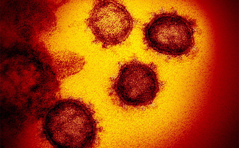 This transmission electron microscope image shows SARS-CoV-2, the virus that causes COVID-19, isolated from a patient in the US, emerging from the surface of cells cultured in the lab.