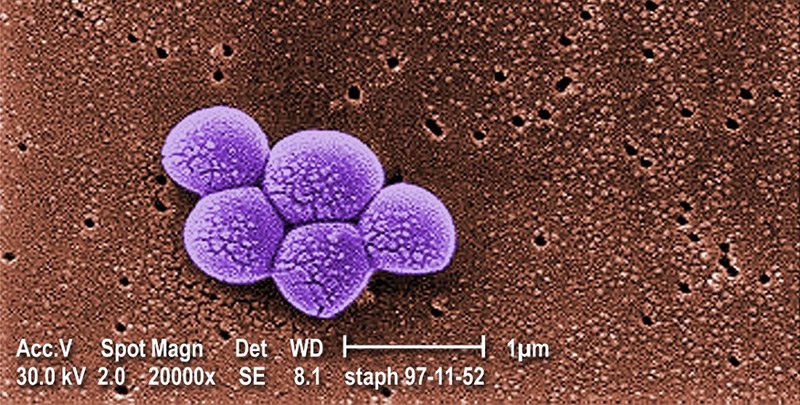 Superbug MRSA, methicillin resistant Staphylococcus aureus, magnified 20,000X.