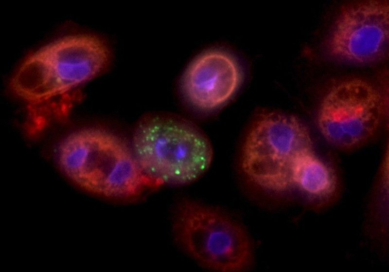 Lung cells infected with coronavirus