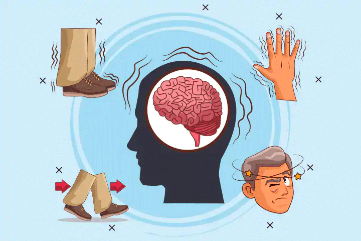 Parkinson's Disease illustration