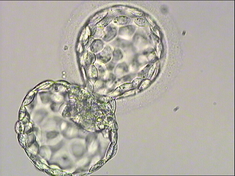 designer embryos