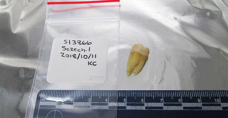 A tooth collected from the medieval Jewish cemetery in Erfurt, Germany. Researchers collected 38 teeth from the excavation site, from which they extracted ancient DNA from 33 individuals.