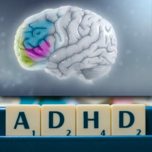 Non-invasive brain stimulation treatment can ease ADHD symptoms in children - HU study
