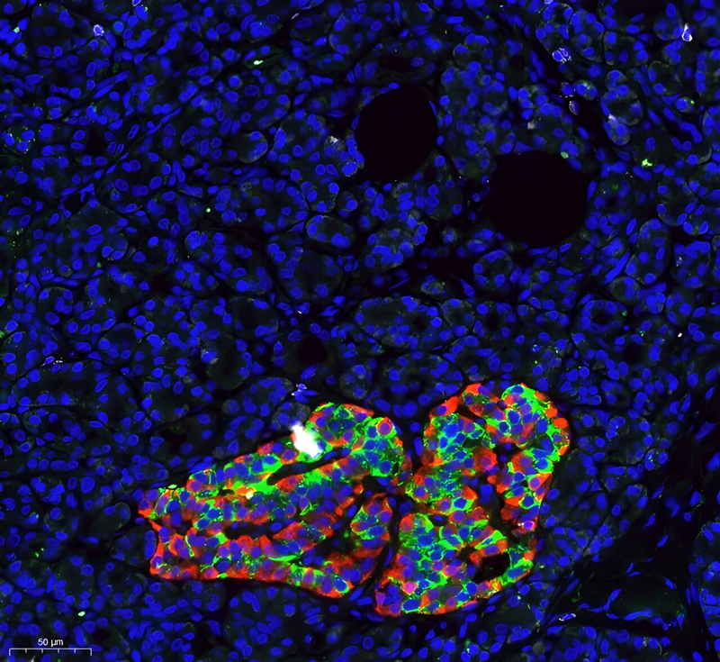 PHOTO: Histological image of the human pancreas, stained with antibodies against insulin (green) and glucagon (red), together marking an islet of Langerhans. Blue labels DNA, marking the nuclei of all pancreatic cells.
