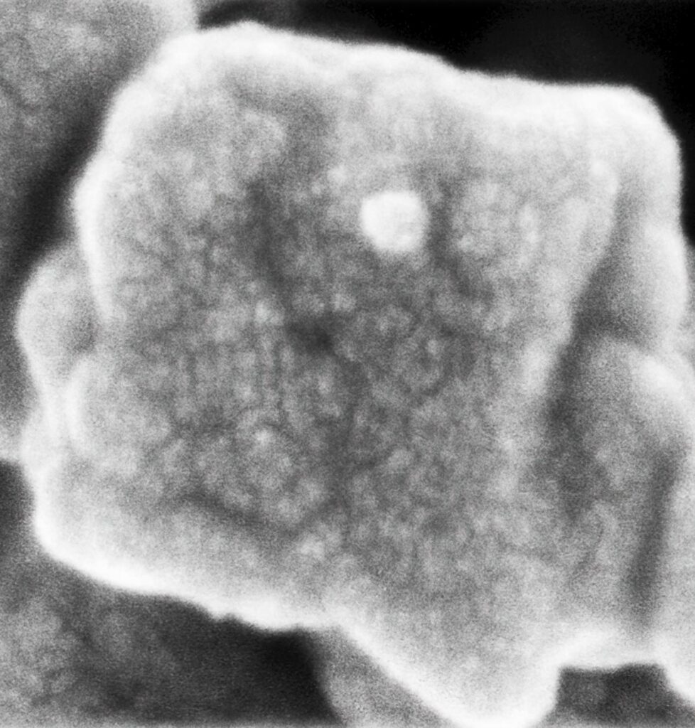From Plants to Bones: Hebrew U Researchers Develop Sustainable Material That Could Help the Body Rebuild Itself
